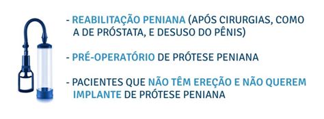 bomba peniana para que serve|Bomba peniana: entenda como pode ajudar no seu。